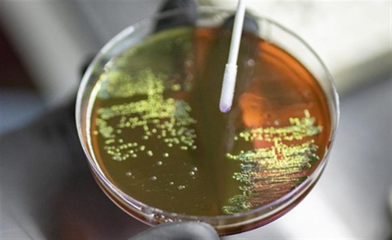 प्रेग्नेंसी के दौरान एंटीबायोटिक के इस्तेमाल से बच्चों में बैक्टीरियल बीमारी का खतरा बढ़ सकता है